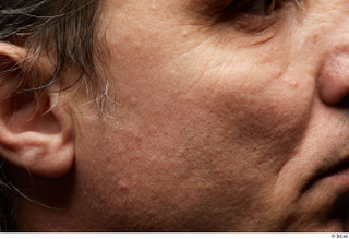 HD Face Skin Benito Romero cheek ear face scar skin…